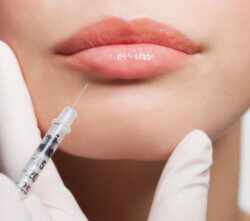 woman getting lip fillers for smokers lines at Emma j aesthetics in inverness